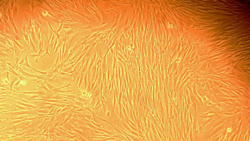 Illustration for article titled ¿Imagen microscópica o paisaje extraterrestre? Adivina cuál es cuál